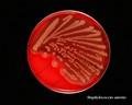 staphylococcus aureus